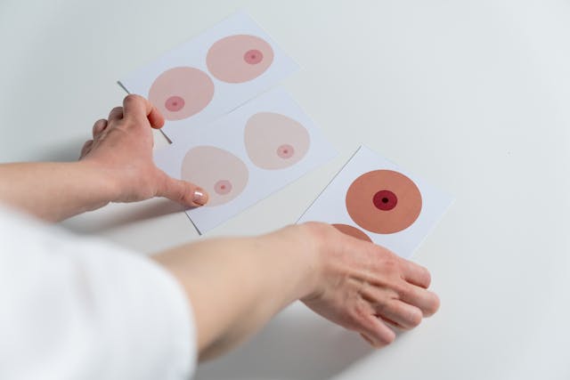 Hvad skal du vælge: brystløft med eller uden implantater